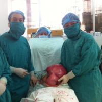 Người phụ nữ mang khối u khủng 10kg trong bụng