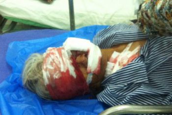 Bi kịch gia đình: Cháu chém chết ông, bà và thím phải mổ cấp cứu để đảm bảo mạng sống.