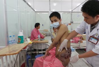 Ổ nhiễm trùng như “tổ ong” trên cơ thể người bệnh Hemophilia