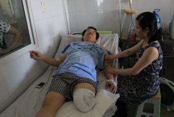 Chữa sai khớp 4 ngày, bệnh nhân bị cắt chân