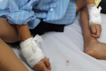 Mổ nhầm tay bé 6 tuổi: Đình chỉ bác sỹ 1 tháng