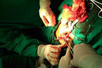 Cấp cứu kịp thời, cứu sống sản phụ mang thai ngoài tử cung vỡ