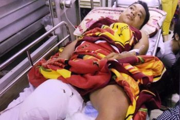Phải cưa chân vì bác sỹ chẩn đoán… “chấn thương phần mềm”