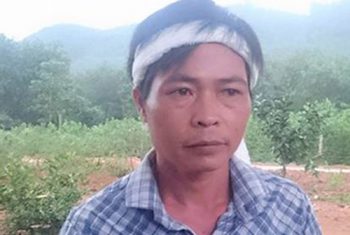 Sản phụ tử vong bất thường cùng mẩu xuơng trong tử cung