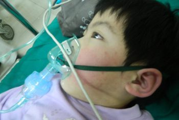 Một phụ nữ sốc phản vệ nguy kịch sau nhổ răng thoát chết hi hữu