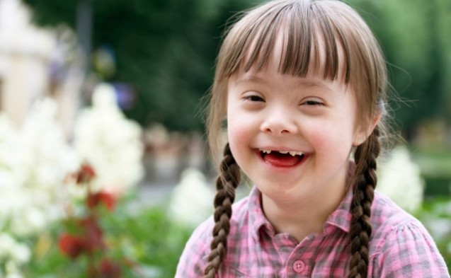 sindrome down 2 637x393