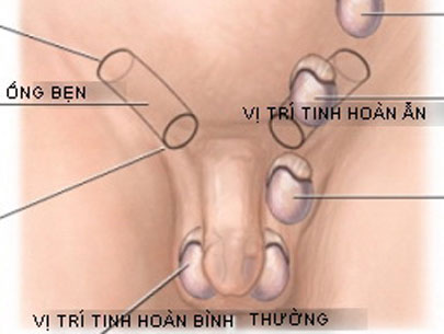 h1 1412255886673