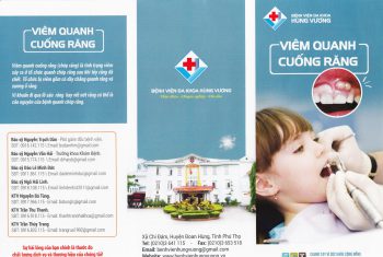 Những điều cần biết về bệnh viêm quanh cuống răng