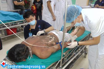 Cấp cứu bệnh nhân bị bỏng – Cảnh báo với chất dễ cháy