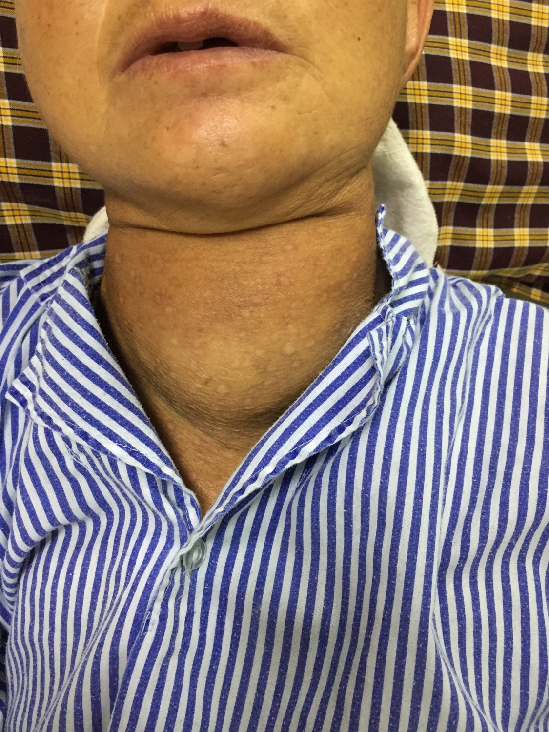 IMG 0881