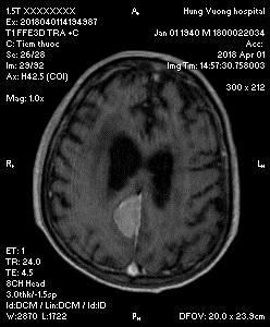 Thinh MRI