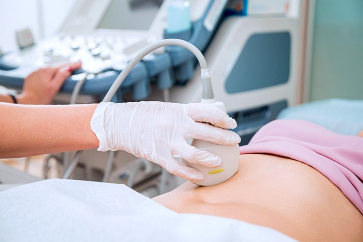 20170923 145442 527262 Subchorionic Hemato max 1800x1800