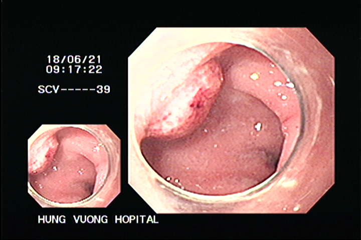 cap05