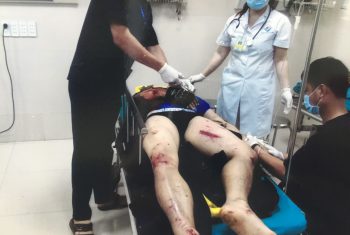 Chấn thương vô cùng nghiêm trọng trên người bệnh nhân 24 tuổi do tai nạn giao thông.