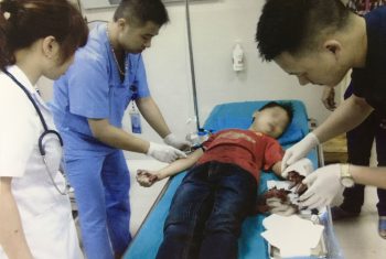 Bé trai 12 tuổi đứt lìa ngón tay do máy thái chuối.