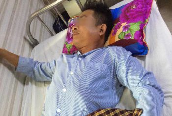 Cả gia đình bị quai bị, con trai biến chứng nguy hiểm.