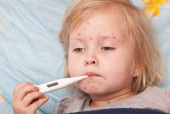 Bệnh sởi gia tăng ngay đầu năm mới, Bộ Y tế khuyến cáo cách phòng bệnh này