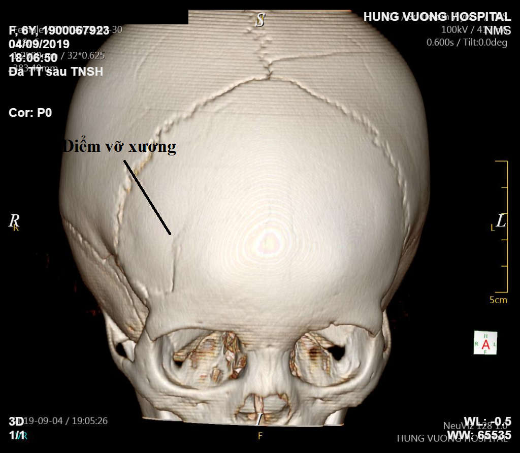 HOÀNG THỊ NGỌC DIỆP 5 1