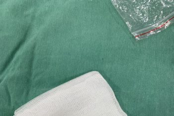 Nội soi lấy viên bi mắc tại dạ dày bé trai 4 tuổi