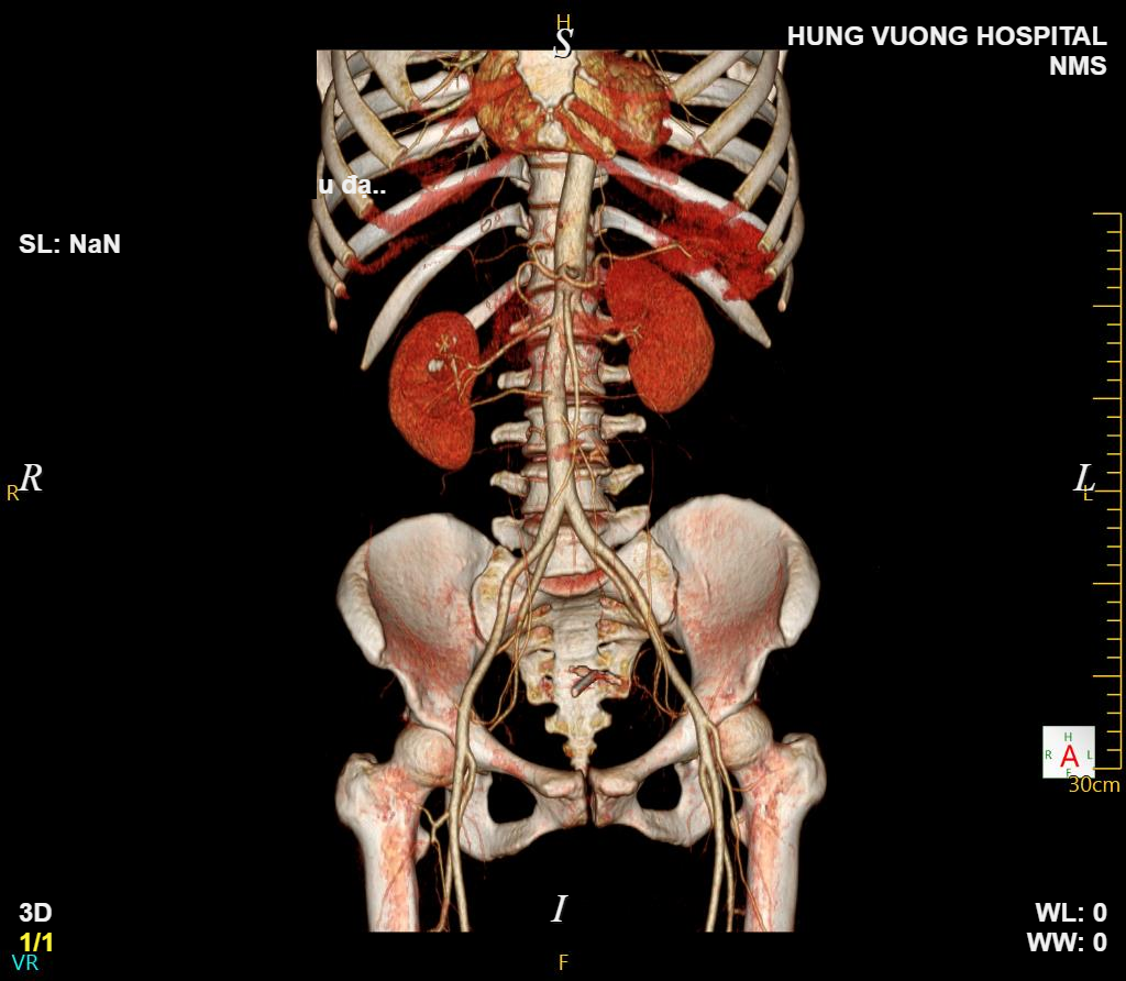 HOÀNG THỊ THẢO 6 1