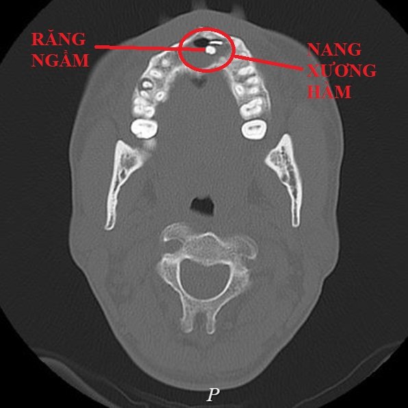 7. Các phương pháp phòng ngừa và phát hiện sớm