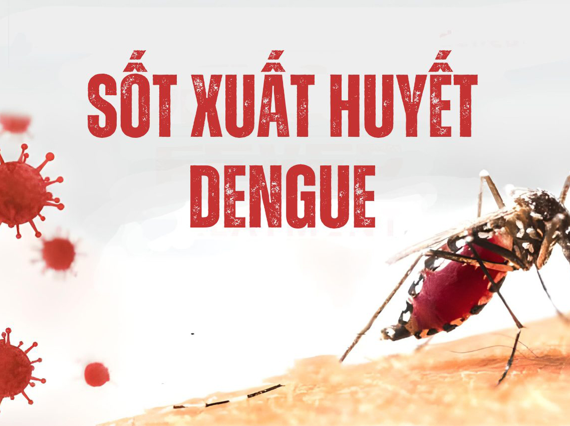 Sốt xuất huyết Dengue: Nguyên nhân, triệu chứng và cách phòng ngừa