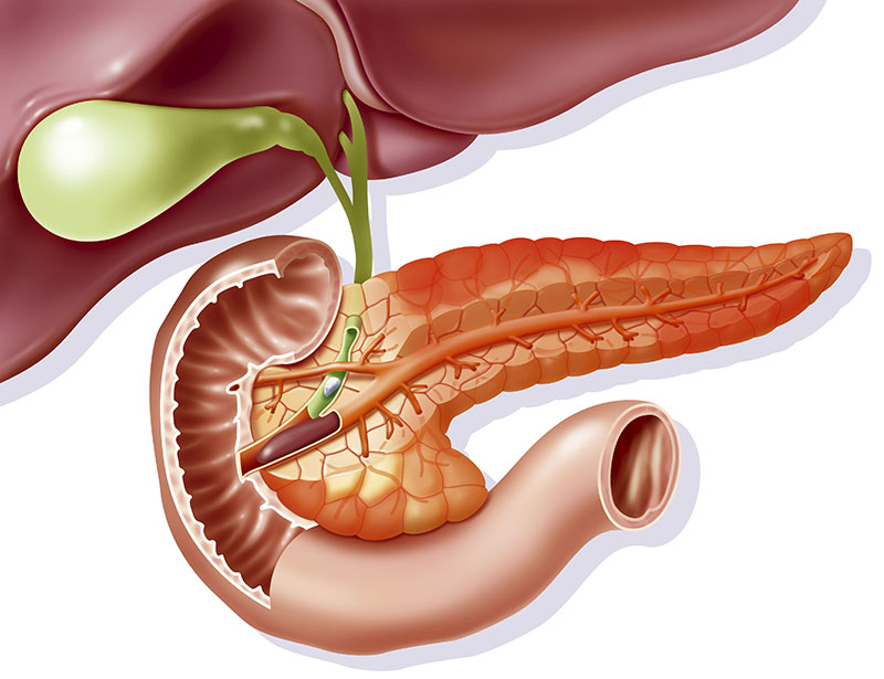 Viêm tụy cấp: nguyên nhân, triệu chứng và điều trị