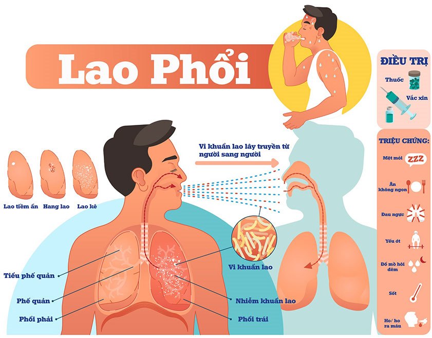 Lao phổi nguy hiểm như thế nào?