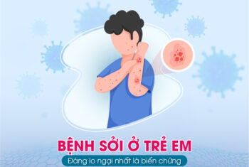 Những điều cần biết về bệnh sởi