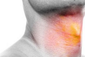 5 nguyên nhân thường gặp gây ung thư họng