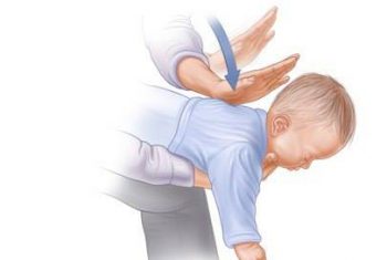 Làm gì khi trẻ bị hóc xương