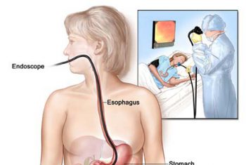 Những điều cần biết về nội soi tiêu hóa
