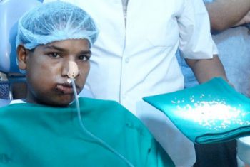 Cậu bé Ấn Độ có 232 chiếc răng dư