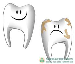 TRẺ EM ĐANG SÂU RĂNG NHIỀU HƠN