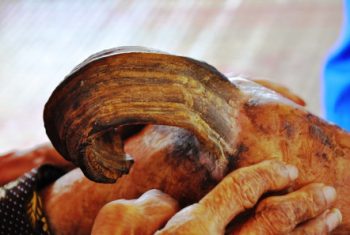 Nam Định: Cụ bà 97 tuổi và chiếc sừng dài 20cm giữa đầu gối