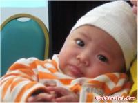 Phát hiện mới trong điều trị bệnh sởi ở trẻ em